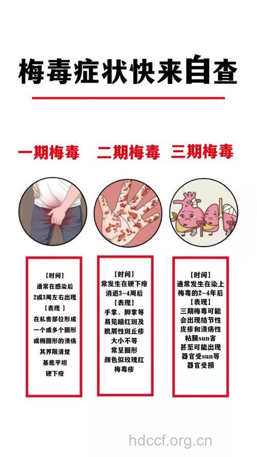梅毒患者要注意哪些细节呢