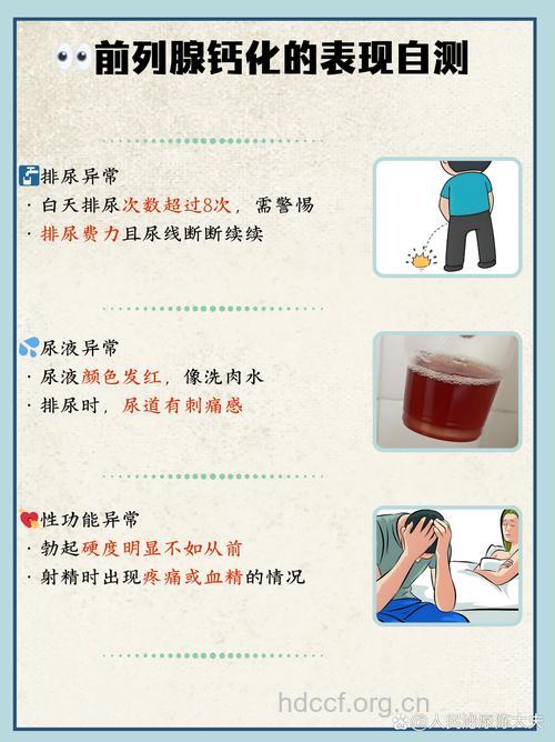 前列腺钙化如何治疗 3个方法效果好