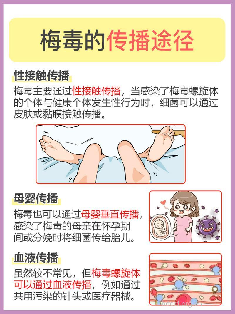 梅毒的传播途径