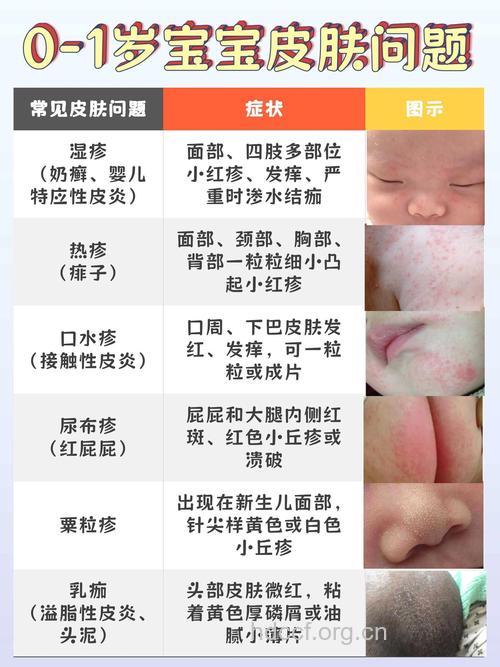 新生儿先后被感染症状与皮肤病有相似处