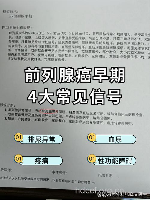 补钙过度小心导致前列腺癌