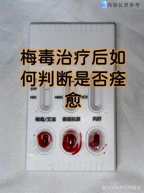 判断梅毒痊愈有何标准？