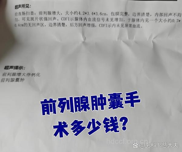 治前列腺囊肿花多少钱