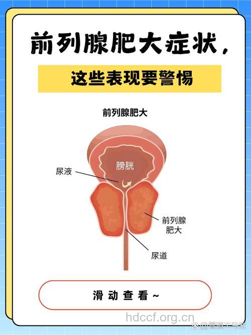 前列腺肥大晚期有哪些症状