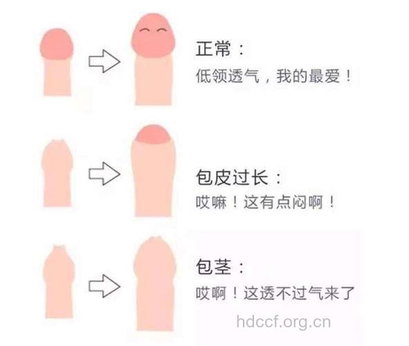 男性有天敌 如何判断包茎和包皮过长的区别