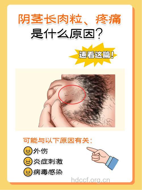 早泄的发病病根是什么