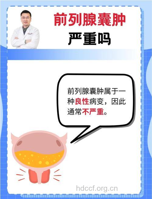前列腺囊肿的常见类型