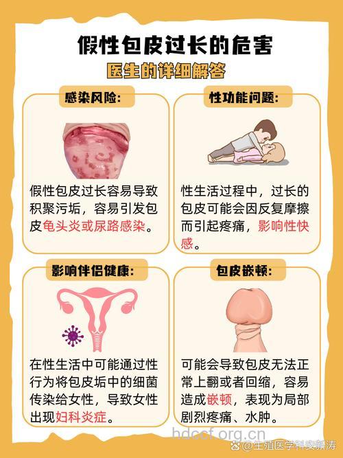 包皮过长对男人的影响有哪些 这些都要注意