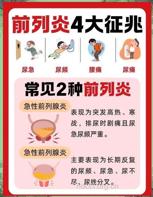 急性前列腺炎的症状表现