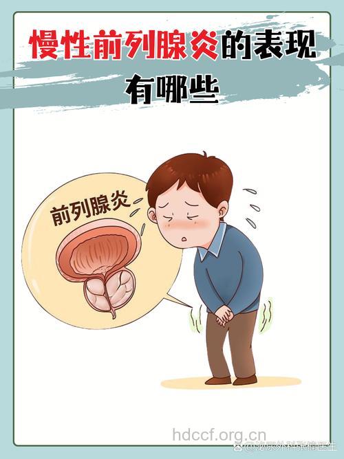 慢性前列腺炎症状表现