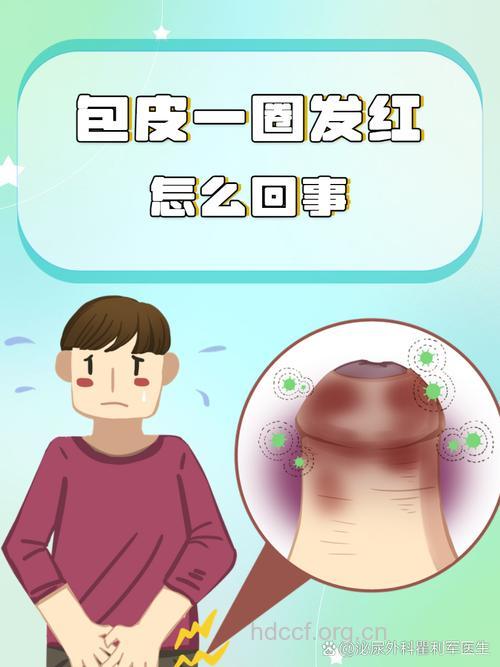 包皮过长不治疗会有哪些并发症