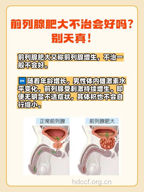 男性前列腺肥大的病因