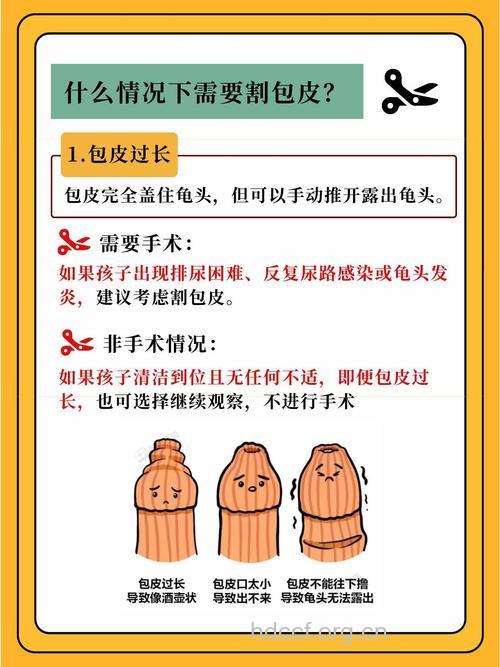 什么情况下男性需要割包皮