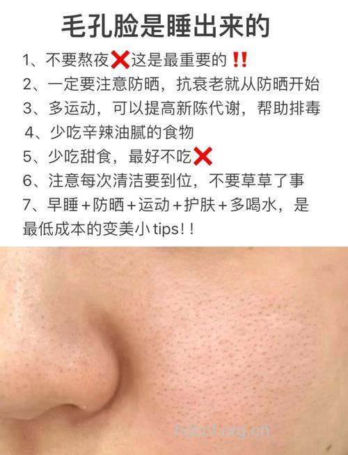 毛孔粗大怎么办 做好护肤五部曲还你童颜