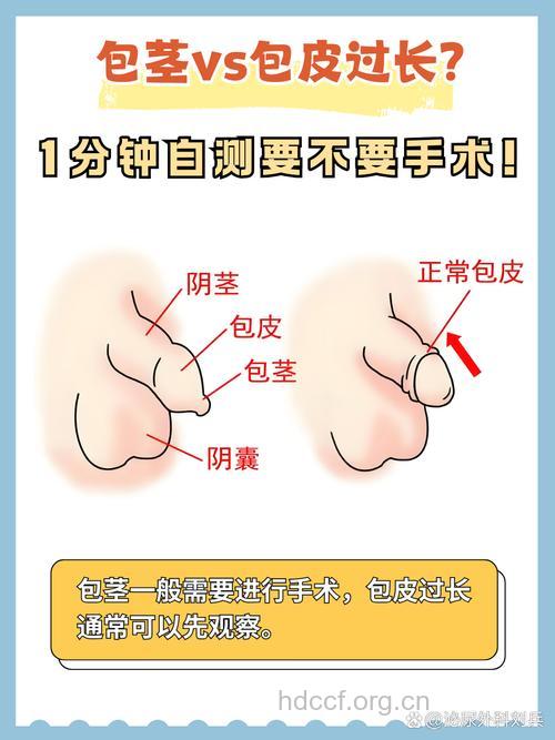 男人包皮过长是怎么样的?跟包茎一样吗