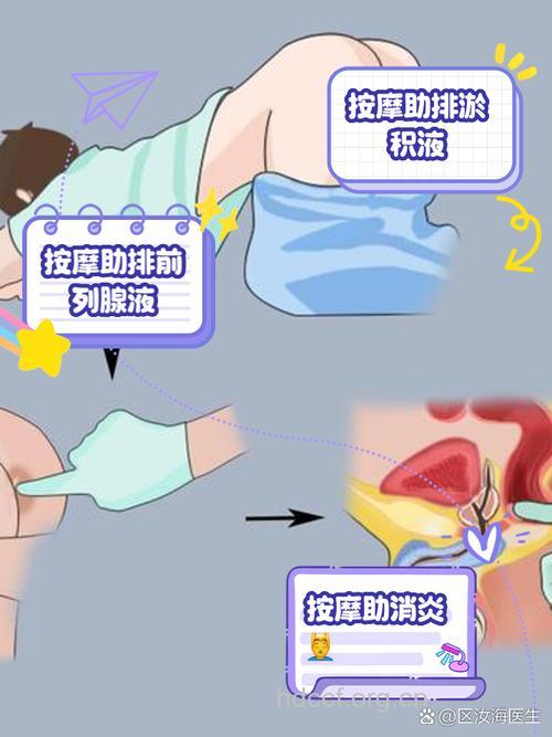 怎么治疗前列腺损伤方法