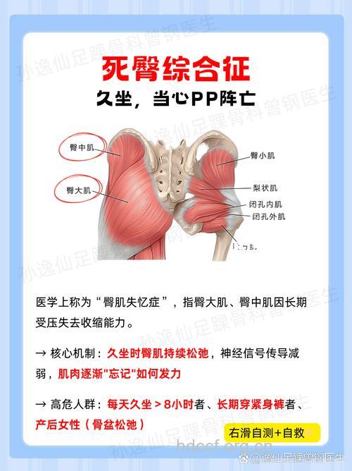 久坐会得死臀综合征 每坐1小时活动10分钟