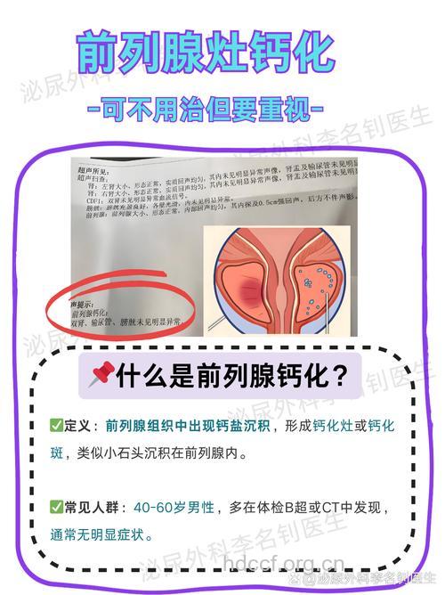 怎么诊断前列腺钙化方法