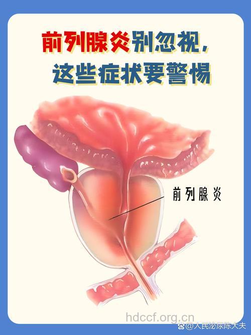 前列腺疾病有那些危险信号