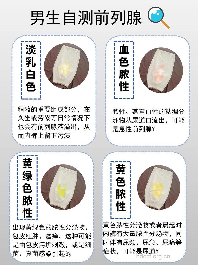 怎么从尿液判断前列腺健康