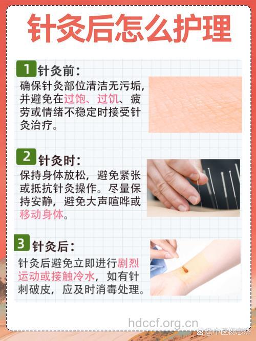 早泄怎么进行针灸疗法呢