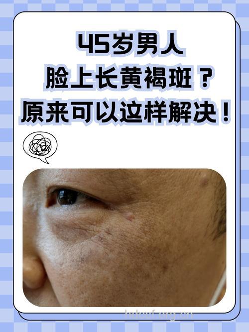 男士皮肤不好是衰老的前兆