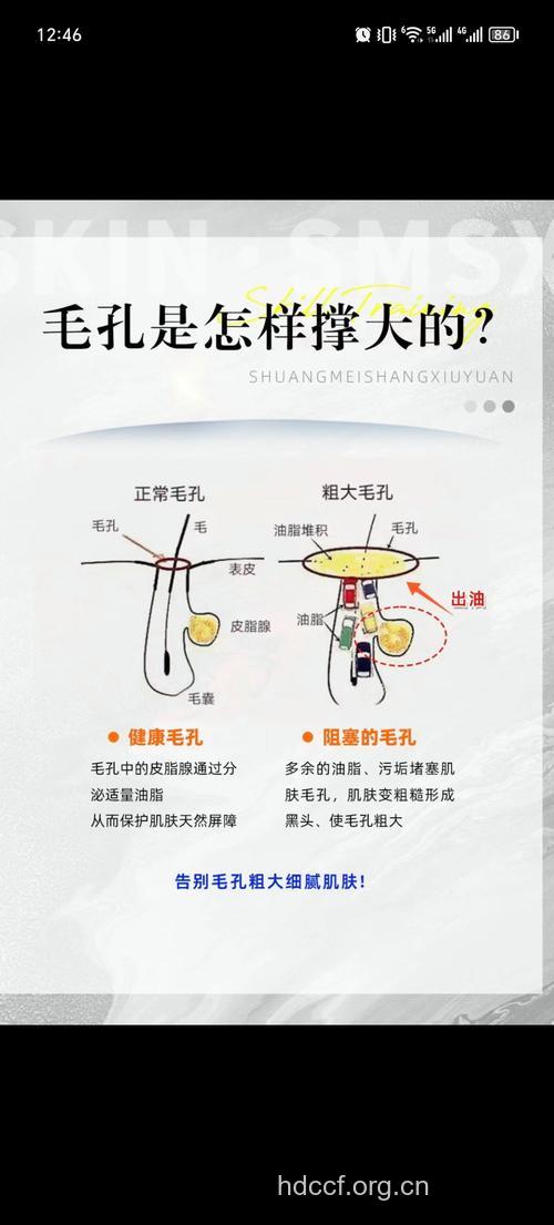 男人皮肤毛孔粗大什么原因 这些因素不可忽视