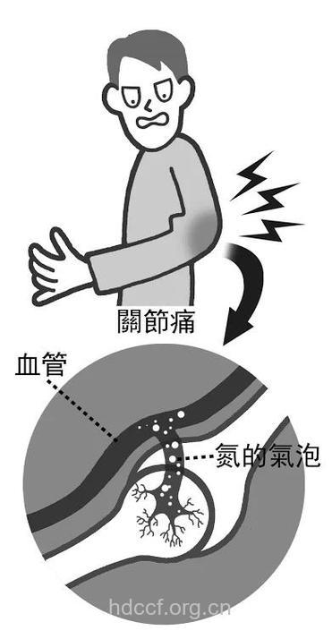 减压要及时 不然会压出8种疾病