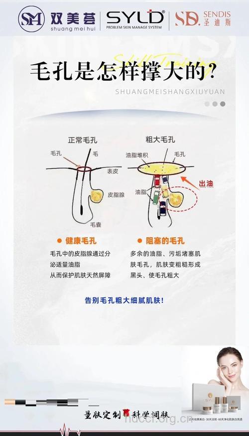男人毛孔粗大的主要原因 如何改善男人毛孔粗大