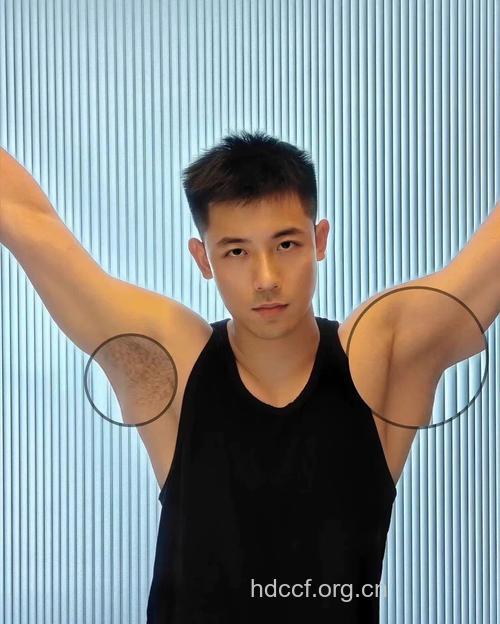 男人的腋毛到底是刮还是不刮?