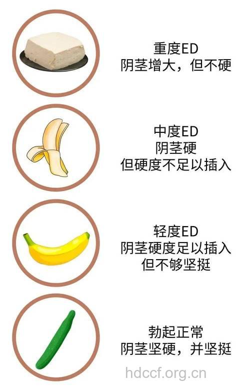 男人性交障碍的症状有哪些