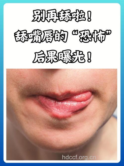 嘴唇干了用舌头舔好吗