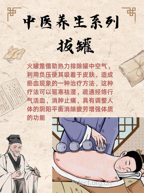 拔罐可养生 男人拔罐的4大好处