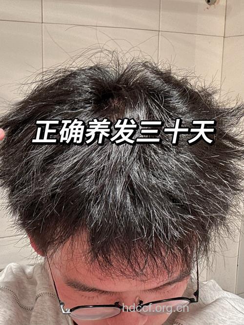 男性头发油腻有11条建议