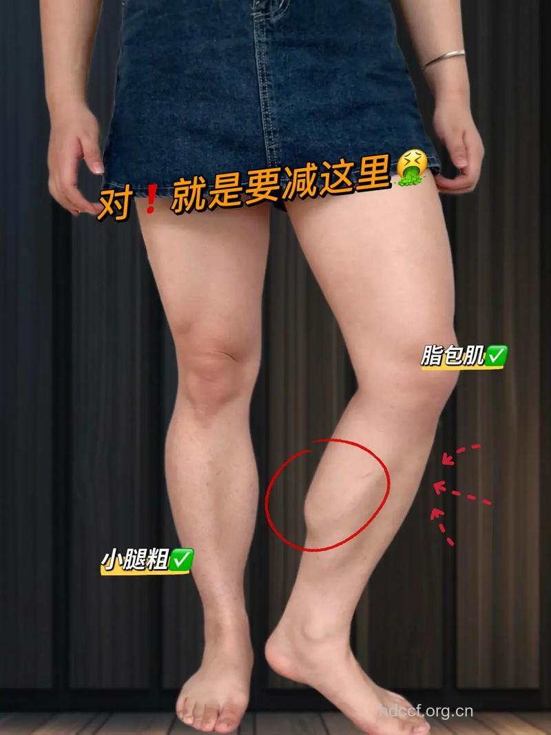 男性腿粗难看 6个方法可瘦腿