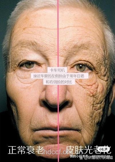 男人肌肤衰老快是什么原因