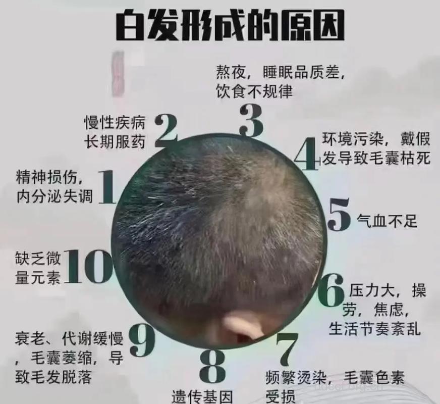 4大因素导致男性出现少白头