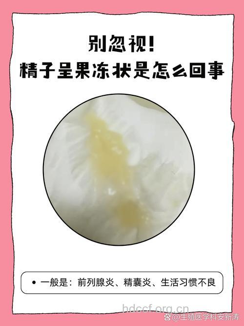 精子异常有哪些表现 几招帮你保护精子