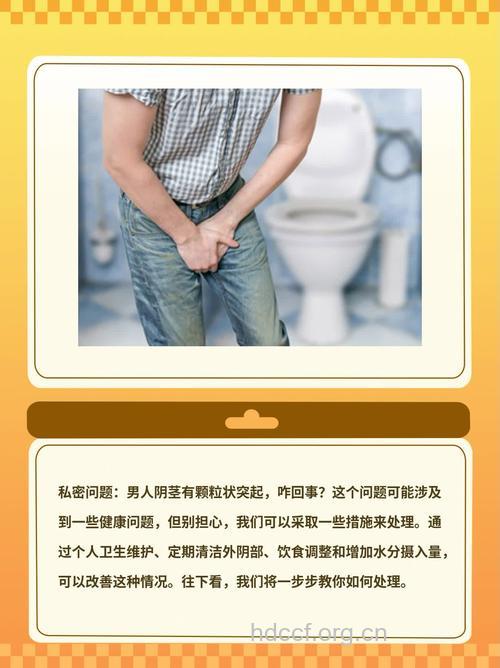 男人上厕所有讲究 这些事危害生殖健康