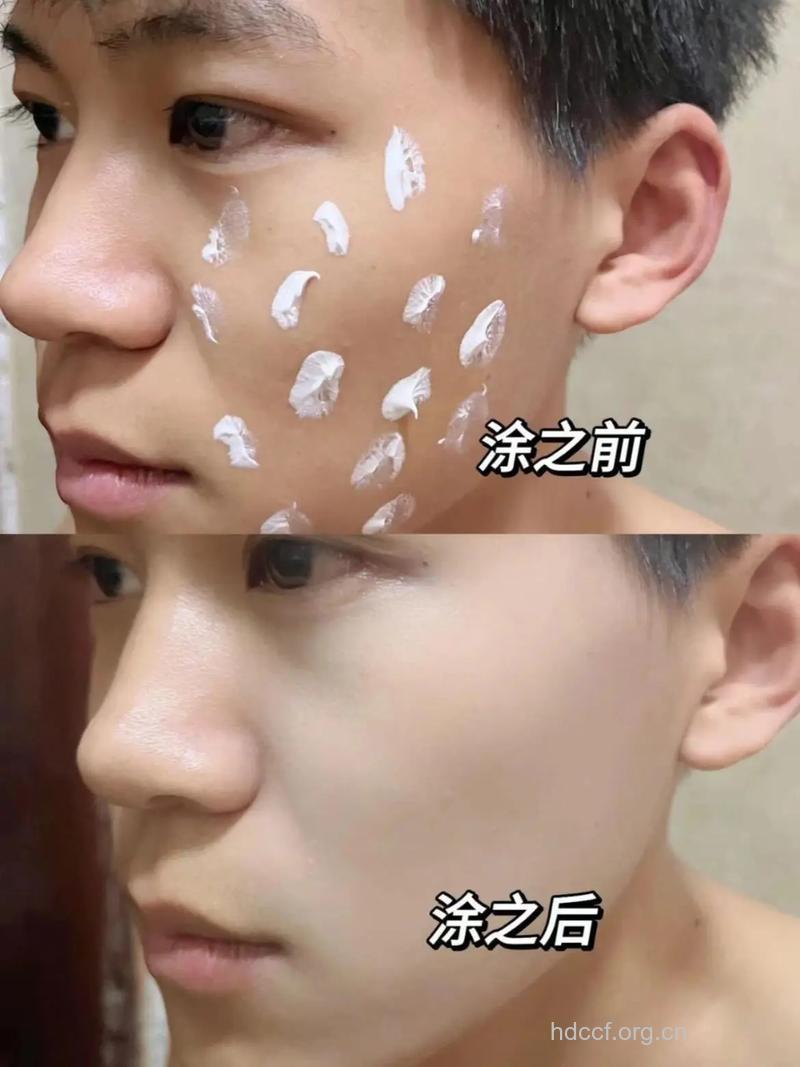 经常上网皮肤变差 男士如何护肤最有效