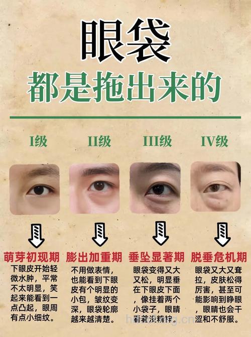 男士眼部浮肿有眼袋 该如何应对和保养