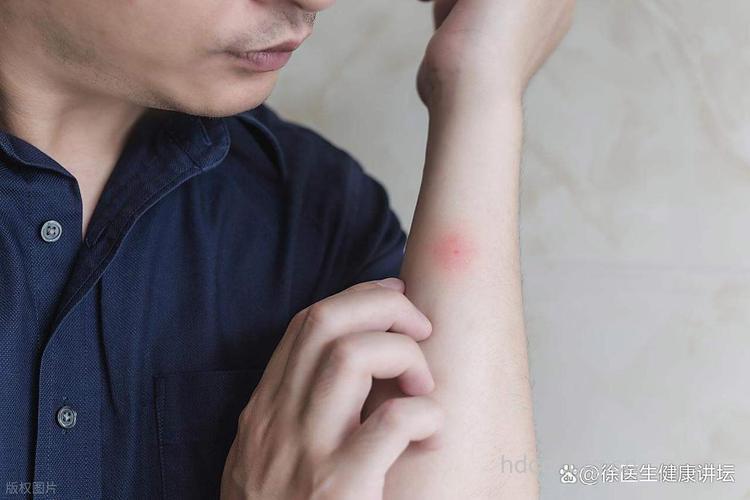 血甜的人容易被蚊子咬吗