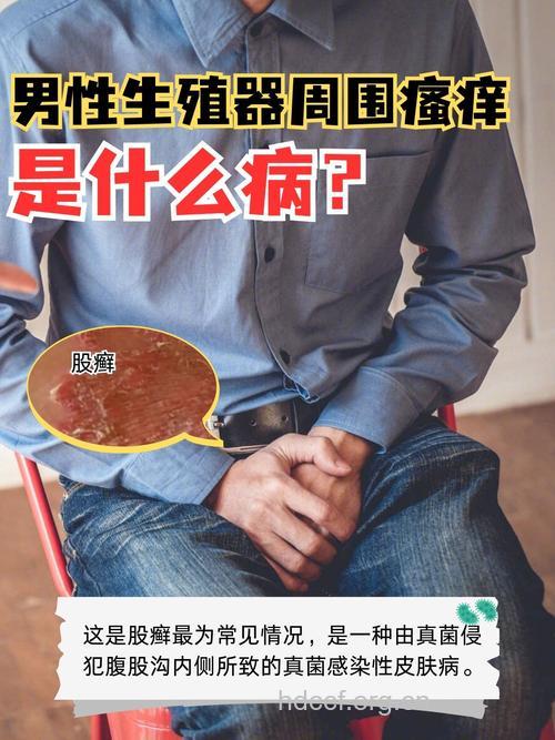 男人阴茎瘙痒是怎么回事 几招帮你保养私处