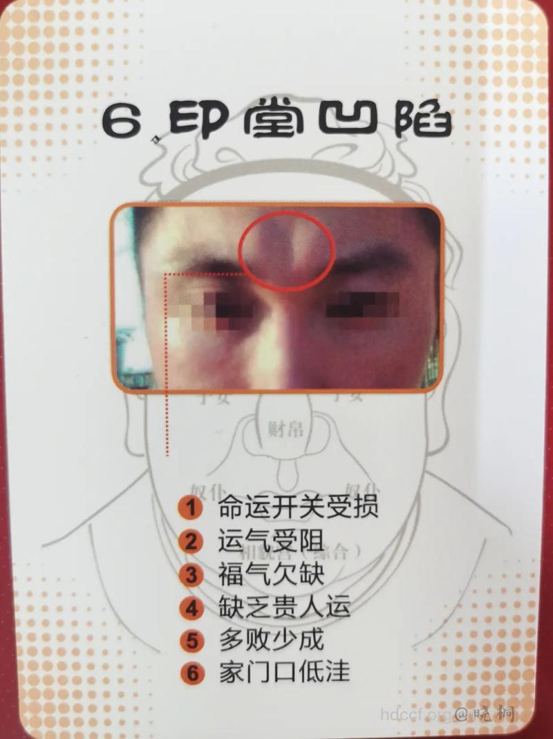 看印堂了解男人健康情况