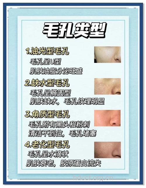 男士收缩毛孔的8个小窍门