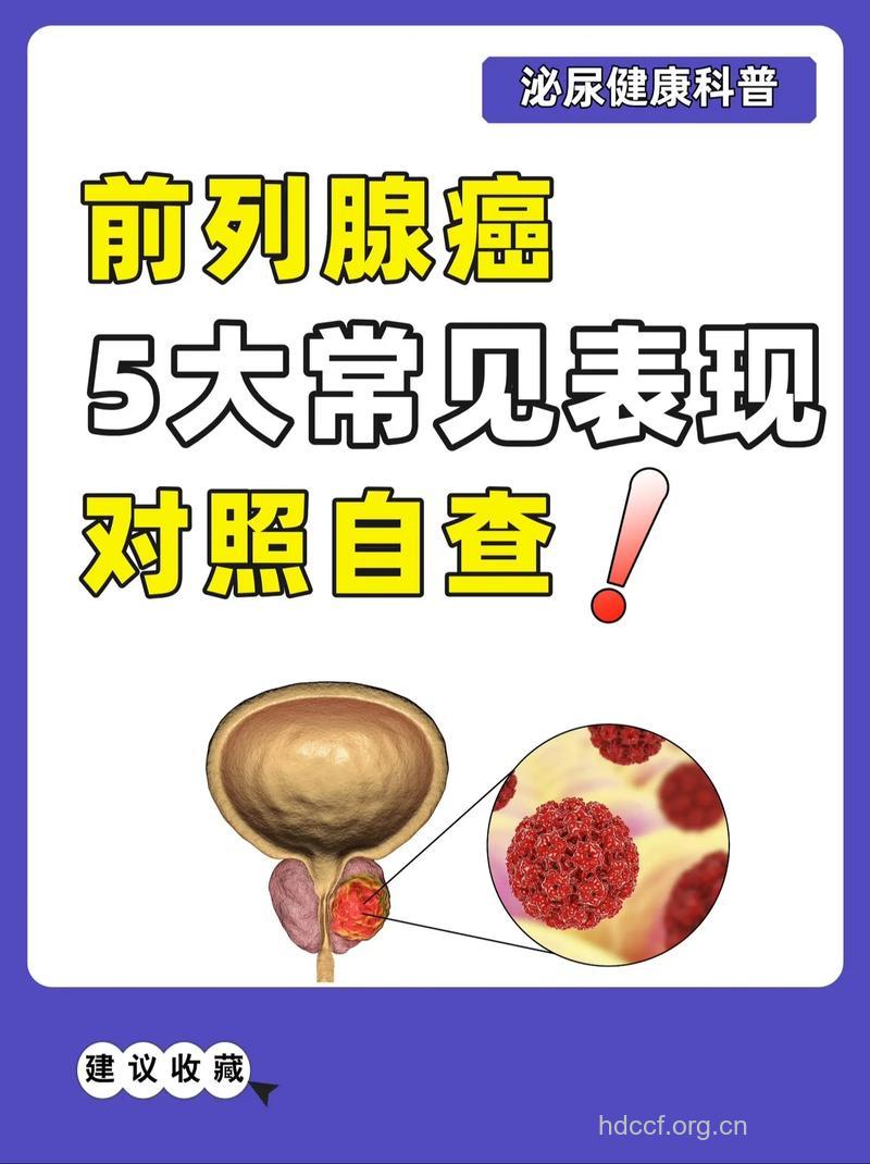 高大壮的男人更易患前列腺癌 这几个症状要当心