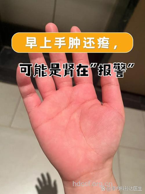 男人肾不好 从手上就可以看出来