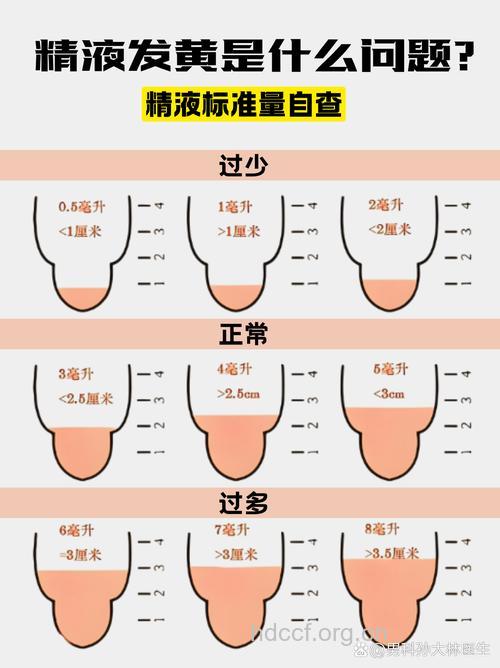 精子的速度与男性不育症 该如何判断
