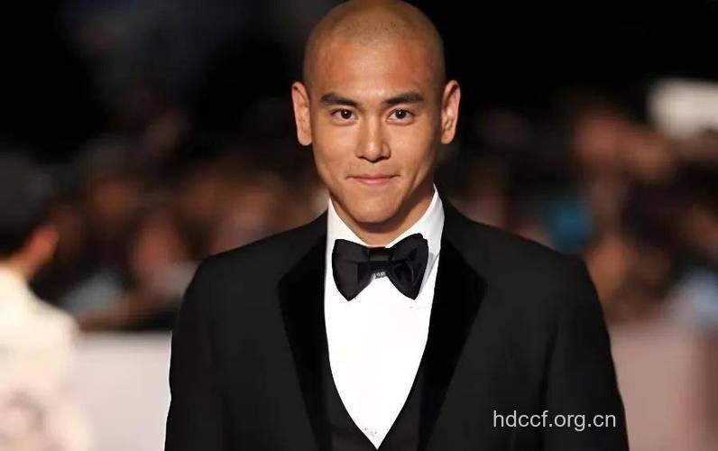 那些光头男星给我们的启示:秃顶预防劳逸结合