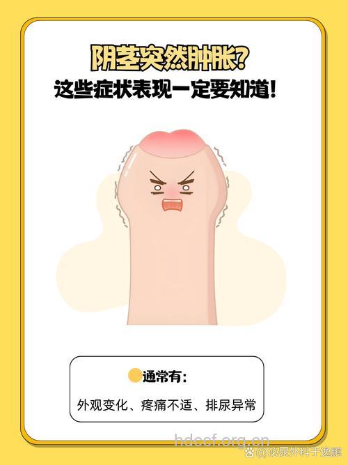 男人性生活过度的症状有哪些